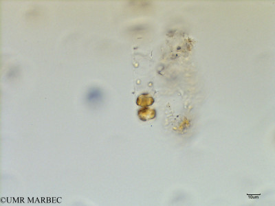 phyto/Scattered_Islands/mayotte_lagoon/SIREME May 2016/Melosira sp2 (MAY7_cf melosira-3).tif(copy)_thumb.jpg